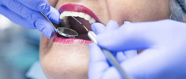 Best Dental Abscess Treatment in Massillon, OH